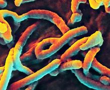 Ebola_Virus_(5)